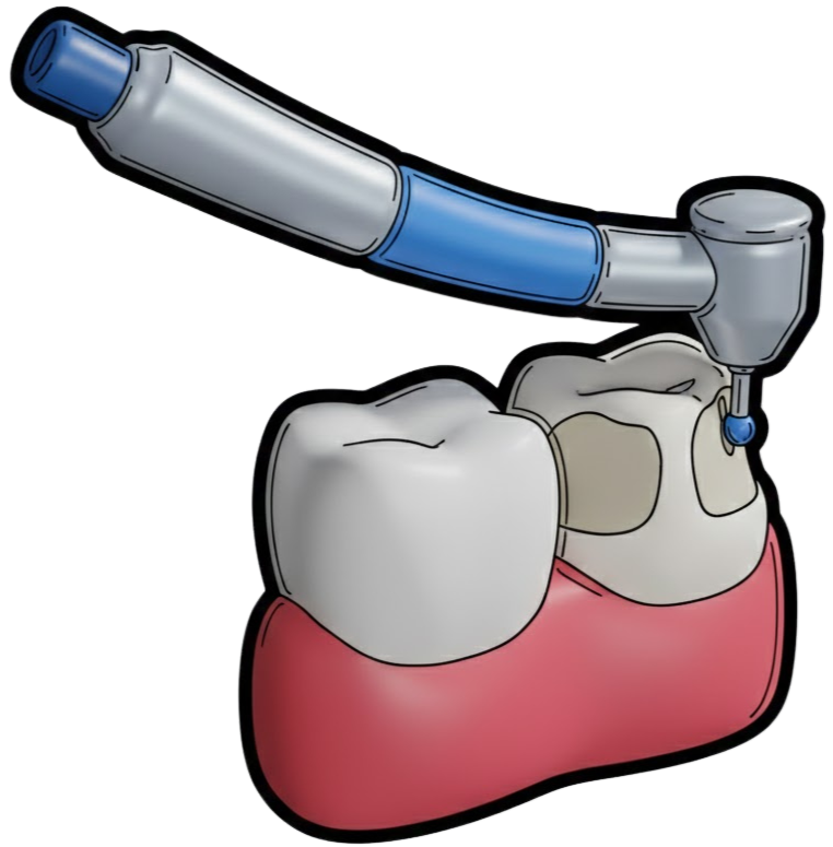 Dental Implant Specialist in Saket