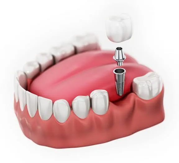 Dental Care in Saket