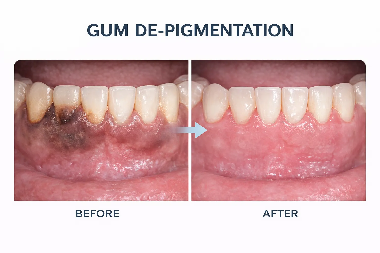 Dentist Near Me in Saket