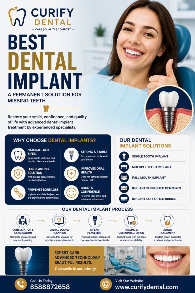Best Dental Implant Saket